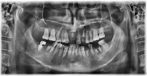 e7800af02c9e654092871ff5fa4a56b4_1759197271_7057.jpg e7800af02c9e654092871ff5fa4a56b4_1759197271_7057.jpg
