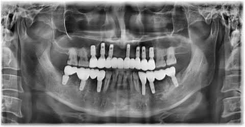 e7800af02c9e654092871ff5fa4a56b4_1759197287_9517.jpg e7800af02c9e654092871ff5fa4a56b4_1759197287_9517.jpg