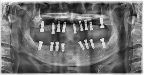 2235036d4a47e5c54dd7906cde74e3e6_1759290784_3974.jpg 2235036d4a47e5c54dd7906cde74e3e6_1759290784_3974.jpg